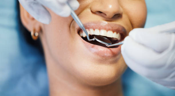 Best Emergency Wisdom Tooth Extraction in Avimor, ID